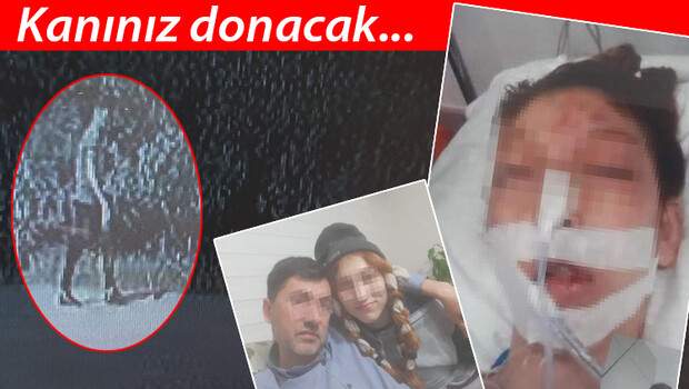 Kocaeli’de dehşete düşüren olay! Cinsel istismara kalkışıp, başına taşla vurdu