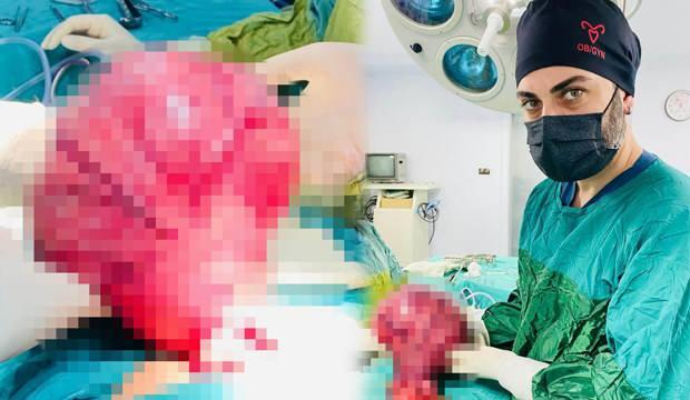 Siirt’te 49 yaşındaki kadın karın ağrısıyla gitti, karnından 4 kiloluk kitle çıkarıldı