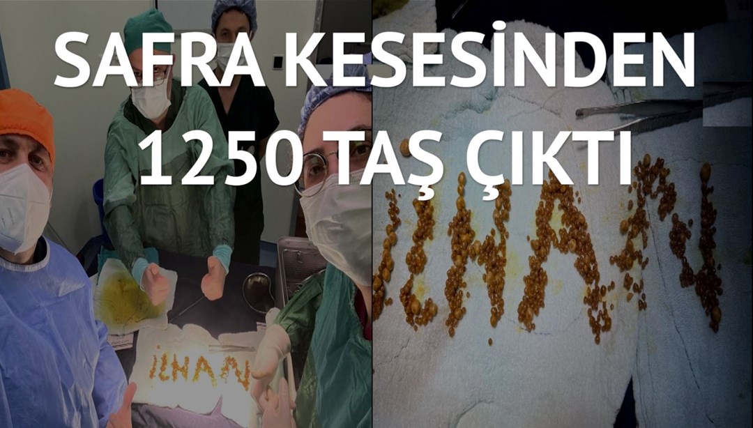 Hastanın safra kesesinden çıkan taşlarla doktor adını yazdı